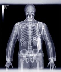Röntgen és annak hatása az emberi szervezetre