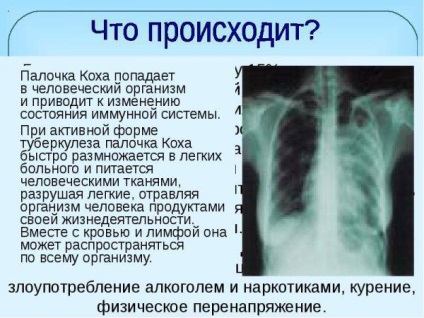 kemoterápiás kezelésben tüdő tuberkulózis szakaszban fázisban hatások