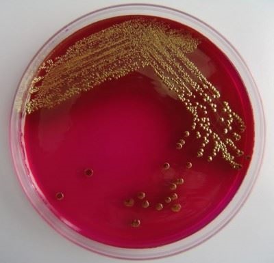 Genus baktériumok Bacillus cereus, subtilis, licheniformis, thuringiensis