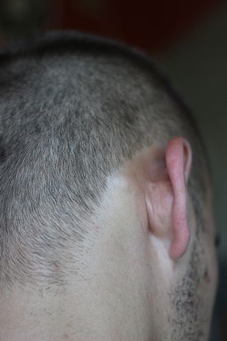 A dudor fáj a fejem, ha megnyomja - Ms - Női Megérzés (fej) A dudor fáj a fejem, ha megnyomja - Ms - Női Megérzés