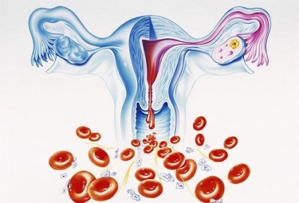 Tünetei oligomenorrhea és okainak menstruációs rendellenességek