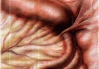 Adhesive bélelzáródás - okai, tünetei, diagnózis és kezelés (diagnosztika) Adhesive bélelzáródás - okai, tünetei, diagnózisa és kezelése
