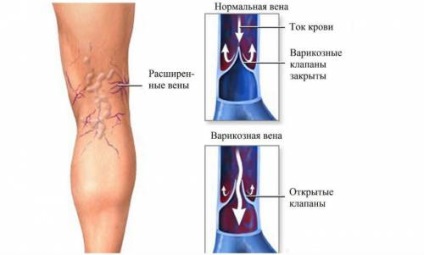 Doppler ultrahang az alsó végtagok hajók (vénák és artériák) (ultrahang) Doppler ultrahang Az alsó végtagok hajók (vénák és artériák)