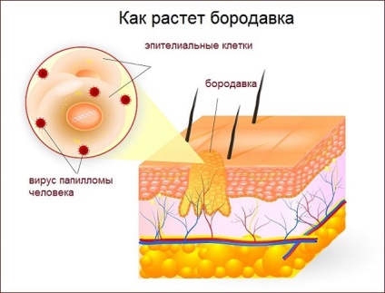 giardia sárga széklet tünetei hpv gorge vírus