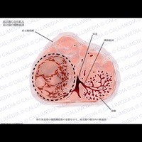 Különböző műtéti prosztata adenoma kezelésére