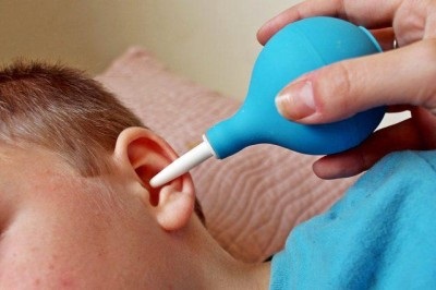 Fülzsír a fül a gyermek mit kell tenni, hogyan kell kezelni otthon