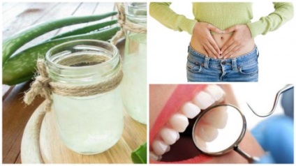 Aloe vera juice Ezért hasznos, és hogyan kell főzni, hogy (szakács) Aloe vera juice Ezért hasznos és hogyan kell főzni