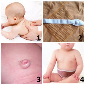 Bandage újszülöttek által köldöksérv hasznosság és használati szabályok