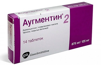 Tüdőgyulladás gyermekek tünetei és kezelése otthon és a kórházban (bronchopneumoniát) Tüdőgyulladás gyermekek tünetei és kezelése otthon és kórházban