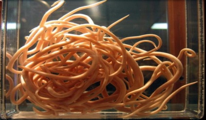 A veszélyesebb az emberi orsóféreg (nagyon súlyos következményekkel jár) A veszélyesebb az emberi roundworm
