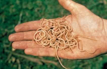 A veszélyesebb az emberi roundworm