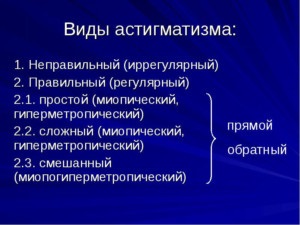 Mi astigmia felnőtt és egy gyermek (fotó) - Mi ez veszélyes, és hogyan, hogy ha (felnőtt) Mi astigmia felnőtt és egy gyermek (fotó) - Mi ez veszélyes, és hogyan, hogy lássa,