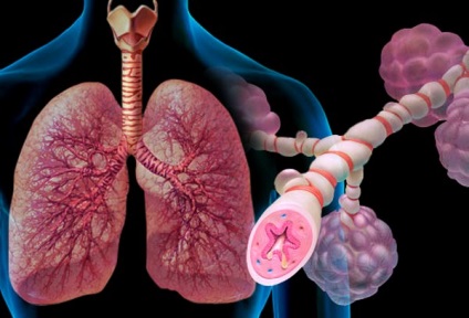 Hogyan kezelik a köhögés, asthma bronchiale