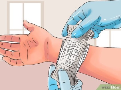Hogyan tisztítható kis seb (Layer antibiotikum kenőcsök) Hogyan tisztítható egy kis seb