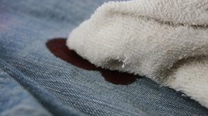 Hogyan mossa a szárított vért a ruhát otthon