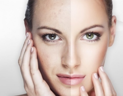 Cream fekete gyöngy, 36 év után cosmetologists vélemény a sorozat samoomolozhenie 36 és adaptív krém (gyöngy) Cream fekete gyöngy, 36 év után cosmetologists vélemény a sorozat samoomolozhenie 36 és adaptív krém