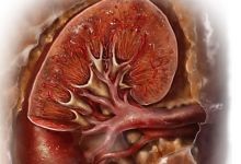 Miért vese vastagbélgyulladás (krónikus periódusban) Miért colitis vese