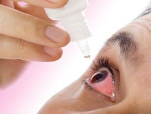 Bőrpír a szemgolyó - okok és a kezelés (oka) Bőrpír a szemgolyó - okok és a kezelés