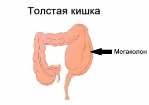 Görcsoldók hatásmechanizmus, javallatok, ellenjavallatok