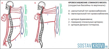 Spinal sztrók okai, tünetei, kezelése és prognózisa a stroke