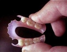 Ultrahangos tisztító fogsor felülvizsgálata gyártók