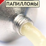 Gyakorlatok és gyakorlatok bél székrekedés (a bél gyakorlatok székrekedés) Gyakorlatok és gyakorlatok bél székrekedés