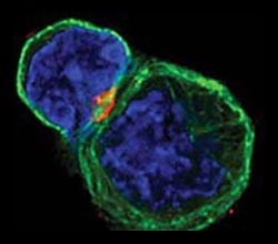 Típusai T-limfocita T-ölősejtek, T-helper sejtek, T-limfociták szupresszor amplifikálható, memória T-sejtek