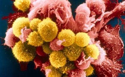 Típusai T-limfocita T-ölősejtek, T-helper sejtek, T-limfociták szupresszor amplifikálható, memória T-sejtek