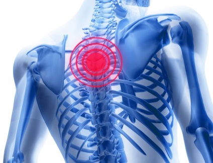 Chondrosis háti gerinc tünetek és a kezelés