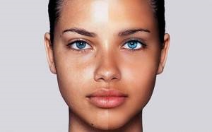 Zsíros bőr arc okai és kezelése