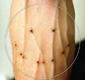 Fehér kínai „, azaz a függőség következményeit, a jelek használata (tünetek) Fehér kínai „, azaz a függőség következményeit, a jelek használata