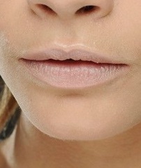 Halvány ajkak lehetséges okait és a korrekció