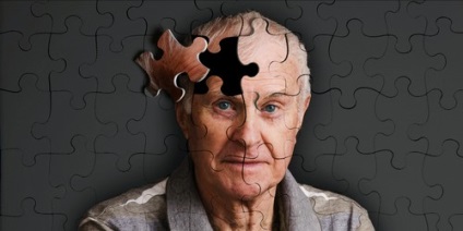 Az Alzheimer-kór jelei és tünetei (Alzheimer-kór fut elég) Alzheimer-kór, a tünetek és jelek