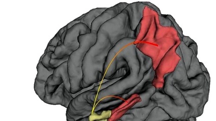 Alzheimer-kór, a tünetek és jelek (tünetek) Alzheimer-kór, a tünetek és jelek
