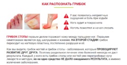 Ami nagyon fél a köröm gombás hagyományos kezelések (kezelések) Ami nagyon fél a köröm gomba hagyományos kezelések