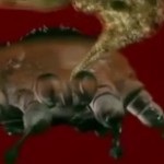 Sarcoptes scabiei (viszketés) rühatka