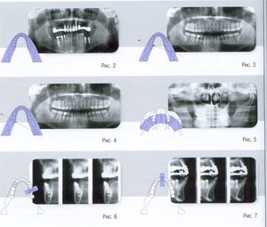 Mi orthopantomograph (tology1) hírlevél