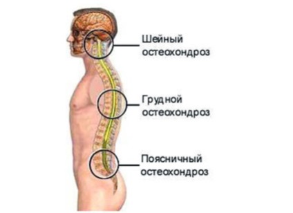 Mi osteochondrosis koncepció a lehető legnagyobb mértékben (a) kezelési Mi osteochondrosis koncepció mértékben lehetséges kezelési