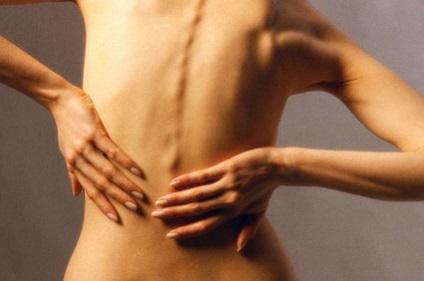 Mi osteochondrosis koncepció a lehető legnagyobb mértékben a kezelés (Rice diéta osteochondrosis) Mi osteochondrosis koncepció mértékben lehetséges kezelési