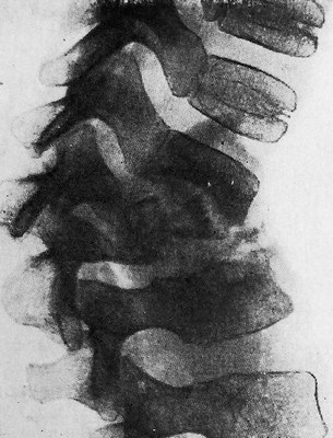Megsemmisítése a csont, a Journal of Medical cikkek „fiatal orvos” (megsemmisítés) Megsemmisítése a csont, a Journal of Medical cikkek „fiatal orvos”
