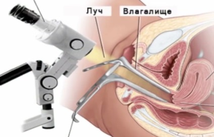 Diagnózis a méh mióma (diagnózisa méhmióma) Diagnózis méh mióma