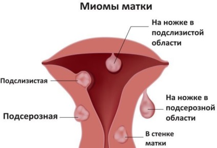Elhúzódó vérzés menstruáció után okok, tünetek