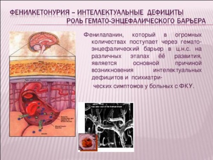 Phenylketonuria okoz, formák, a tünetek, diagnózis, kezelés