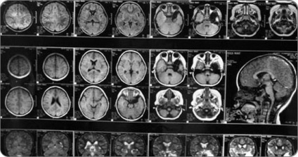 Amennyiben az MRI a fej Budapest, Volokolamsk autópálya, 95