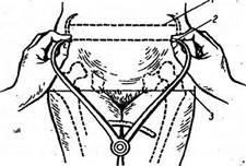 Mérési nagy medence (pelviometriya) - studopediya (mérés ekkora) Mérési nagy medence (pelviometriya) - studopediya
