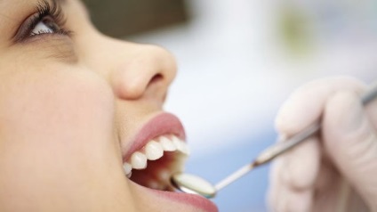 Mi a jobb tömítés az elülső fogak anyagválasztás