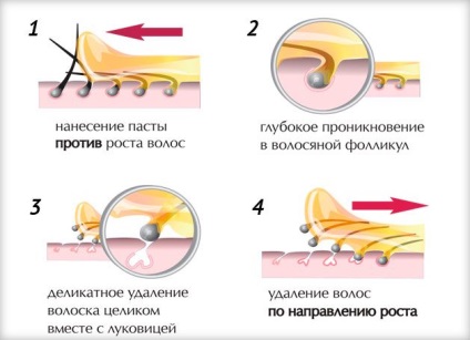 Hogyan shugaring bikini otthon