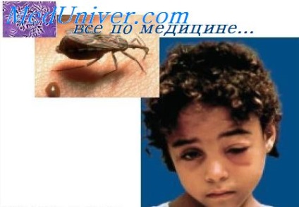 Clinic A Lyme borreliosis (Lyme borreliosis Clinic) Clinic Lyme borreliosis