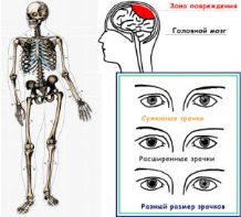 Rövid tájékoztatást az emberi anatómia és élettan