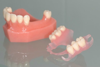 Malocclusion mint veszélyes és hogyan lehet hatékonyan erősít (funkcionális egység akció) Malocclusion mint veszélyes és hogyan lehet hatékonyan erősít